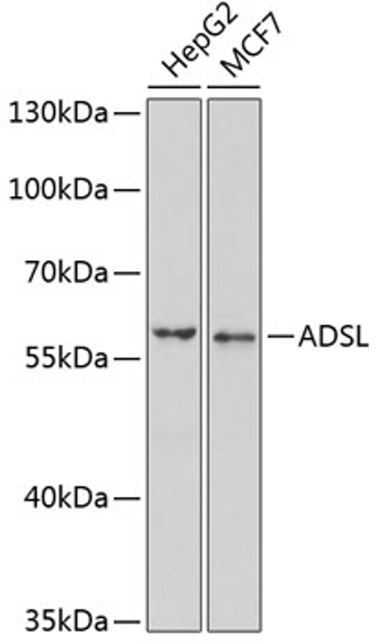 Western blot analysis of extracts of various cell lines, using ADSL antibody (22-098) at 1:1000 dilution.<br/>Secondary antibody: HRP Goat Anti-Rabbit IgG (H+L) at 1:10000 dilution.<br/>Lysates/proteins: 25ug per lane.<br/>Blocking buffer: 3% nonfat dry milk in TBST.<br/>Detection: ECL Basic Kit.<br/>Exposure time: 90s.