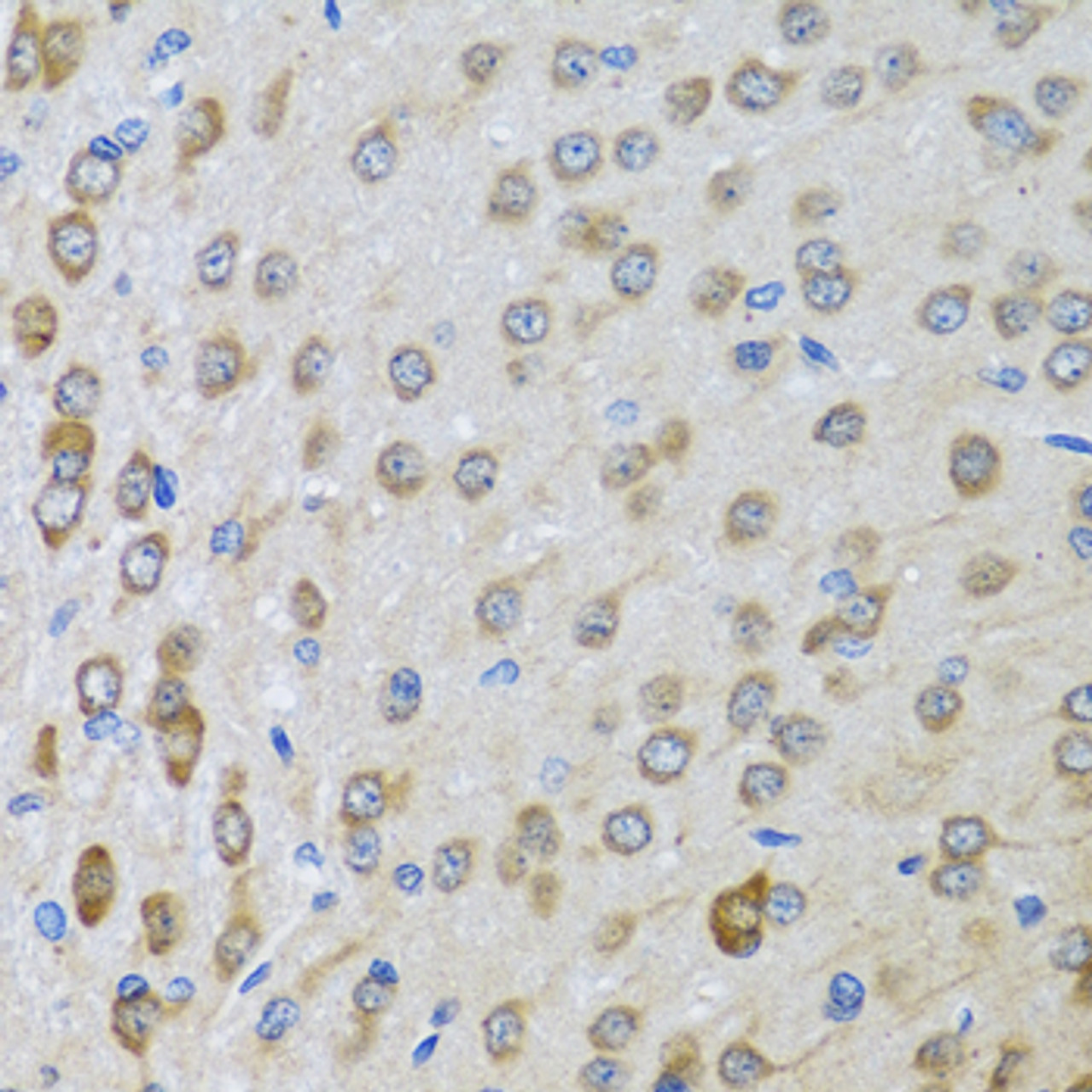 Immunohistochemistry of paraffin-embedded rat brain using BTD antibody (22-100) at dilution of 1:100 (40x lens) .