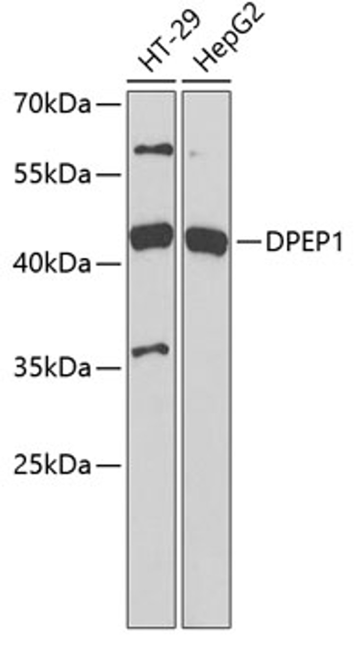 Western blot analysis of extracts of various cell lines, using DPEP1 antibody (22-103) at 1:1000 dilution.<br/>Secondary antibody: HRP Goat Anti-Rabbit IgG (H+L) at 1:10000 dilution.<br/>Lysates/proteins: 25ug per lane.<br/>Blocking buffer: 3% nonfat dry milk in TBST.
