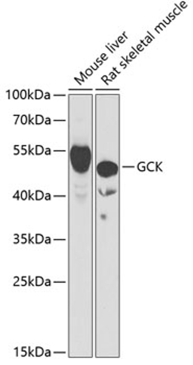 Western blot analysis of extracts of various cell lines, using GCK antibody (22-106) at 1:1000 dilution.<br/>Secondary antibody: HRP Goat Anti-Rabbit IgG (H+L) at 1:10000 dilution.<br/>Lysates/proteins: 25ug per lane.<br/>Blocking buffer: 3% nonfat dry milk in TBST.<br/>Detection: ECL Basic Kit.<br/>Exposure time: 60s.