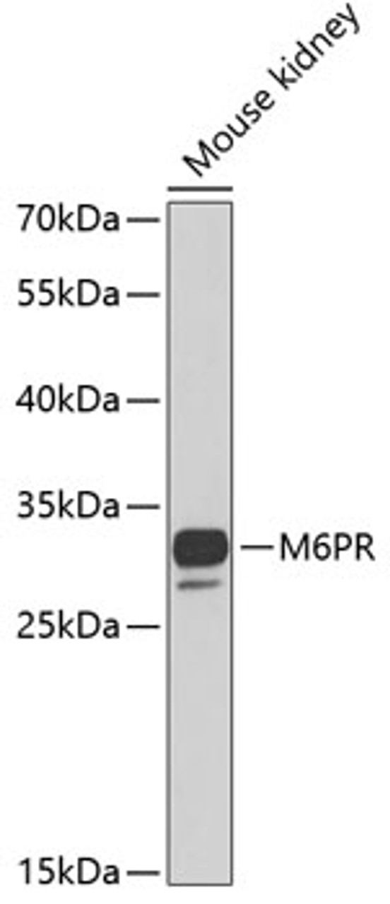 Western blot analysis of extracts of mouse kidney, using M6PR antibody (22-107) at 1:1000 dilution.<br/>Secondary antibody: HRP Goat Anti-Rabbit IgG (H+L) at 1:10000 dilution.<br/>Lysates/proteins: 25ug per lane.<br/>Blocking buffer: 3% nonfat dry milk in TBST.<br/>Detection: ECL Basic Kit.<br/>Exposure time: 40s.