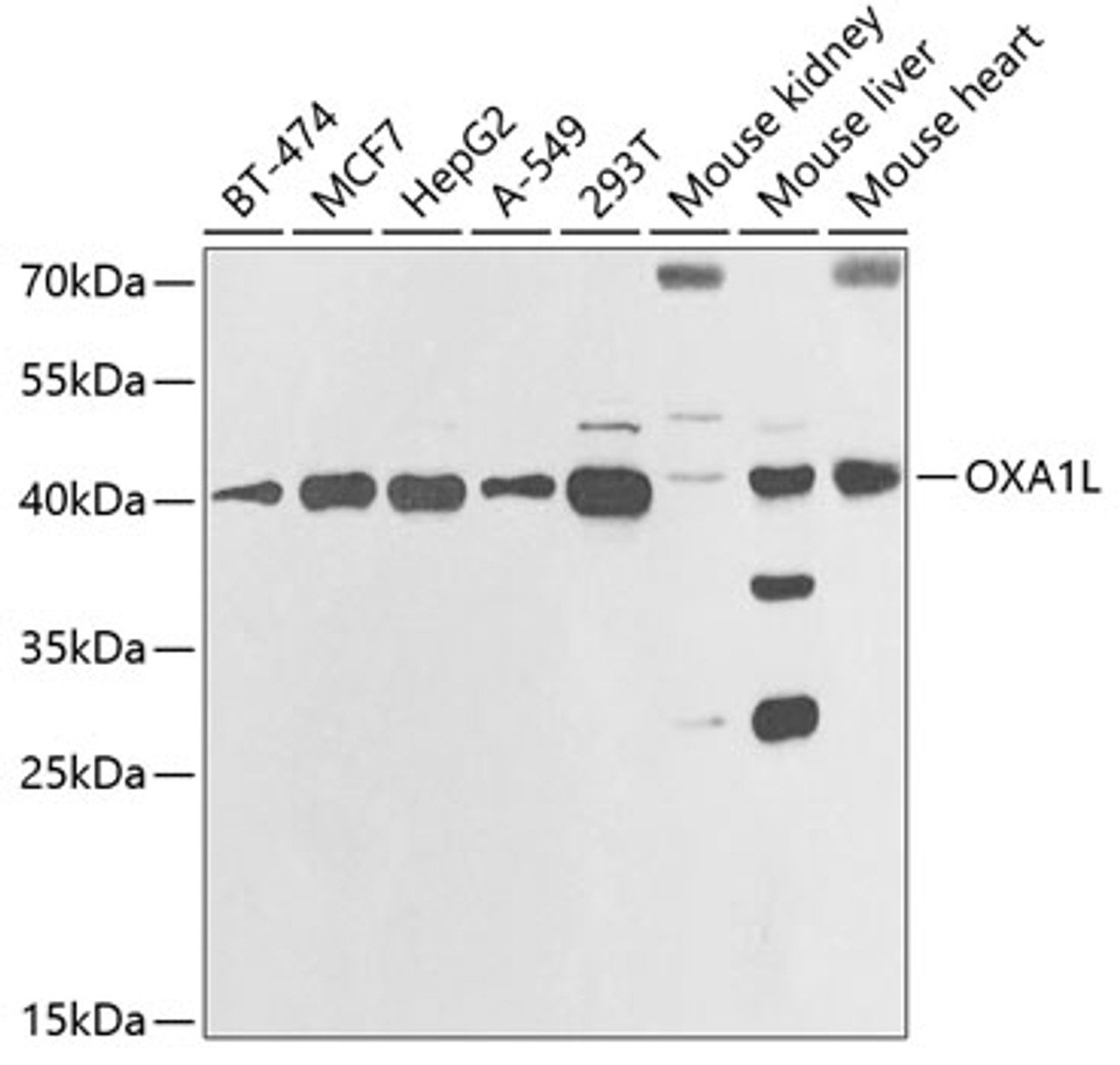 Western blot analysis of extracts of various cell lines, using OXA1L antibody (22-110) at 1:1000 dilution._Secondary antibody: HRP Goat Anti-Rabbit IgG (H+L) at 1:10000 dilution._Lysates/proteins: 25ug per lane._Blocking buffer: 3% nonfat dry milk in TBST._Detection: ECL Enhanced Kit._Exposure time: 60s.