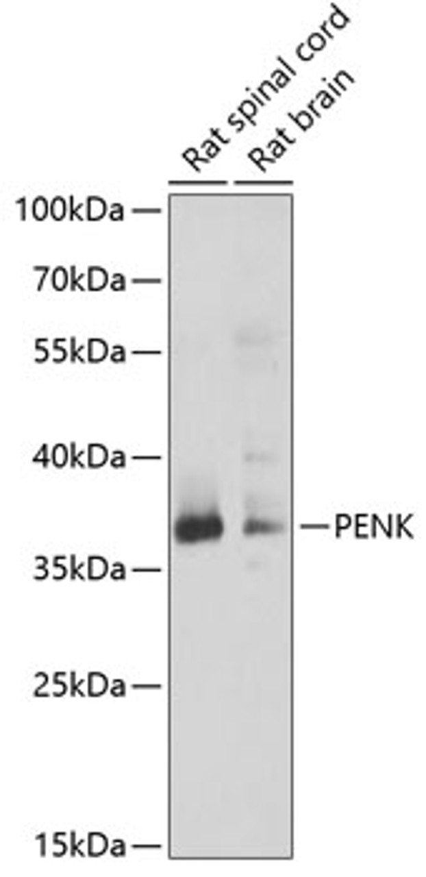Western blot analysis of extracts of various cell lines, using PENK antibody (22-112) at 1:1000 dilution._Secondary antibody: HRP Goat Anti-Rabbit IgG (H+L) at 1:10000 dilution._Lysates/proteins: 25ug per lane._Blocking buffer: 3% nonfat dry milk in TBST._Detection: ECL Enhanced Kit._Exposure time: 20s.