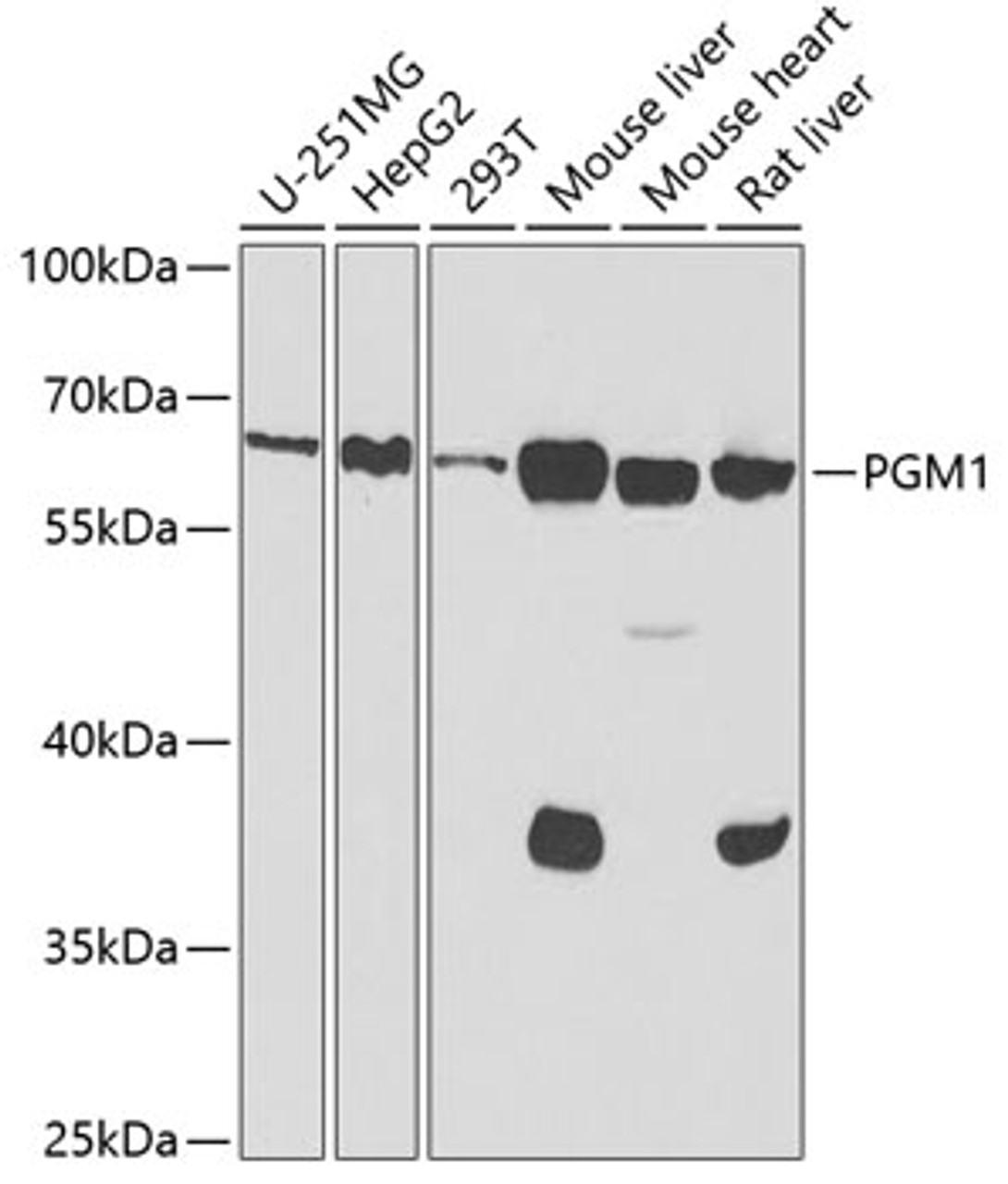 Western blot analysis of extracts of various cell lines, using PGM1 antibody (22-113) at 1:1000 dilution.<br/>Secondary antibody: HRP Goat Anti-Rabbit IgG (H+L) at 1:10000 dilution.<br/>Lysates/proteins: 25ug per lane.<br/>Blocking buffer: 3% nonfat dry milk in TBST.<br/>Detection: ECL Basic Kit.<br/>Exposure time: 60s.