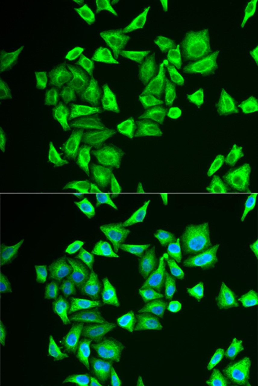 Immunofluorescence analysis of U2OS cells using PGM1 antibody (22-113) . Blue: DAPI for nuclear staining.