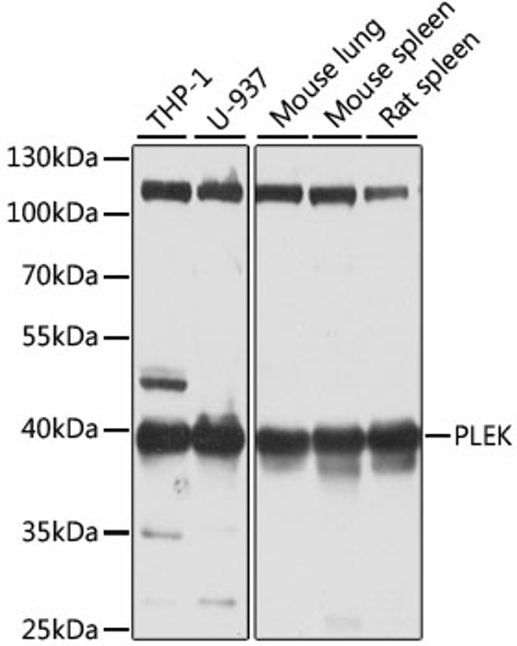 Western blot analysis of extracts of various cell lines, using PLEK antibody (22-114) at 1:1000 dilution.<br/>Secondary antibody: HRP Goat Anti-Rabbit IgG (H+L) at 1:10000 dilution.<br/>Lysates/proteins: 25ug per lane.<br/>Blocking buffer: 3% nonfat dry milk in TBST.<br/>Detection: ECL Basic Kit.<br/>Exposure time: 10s.