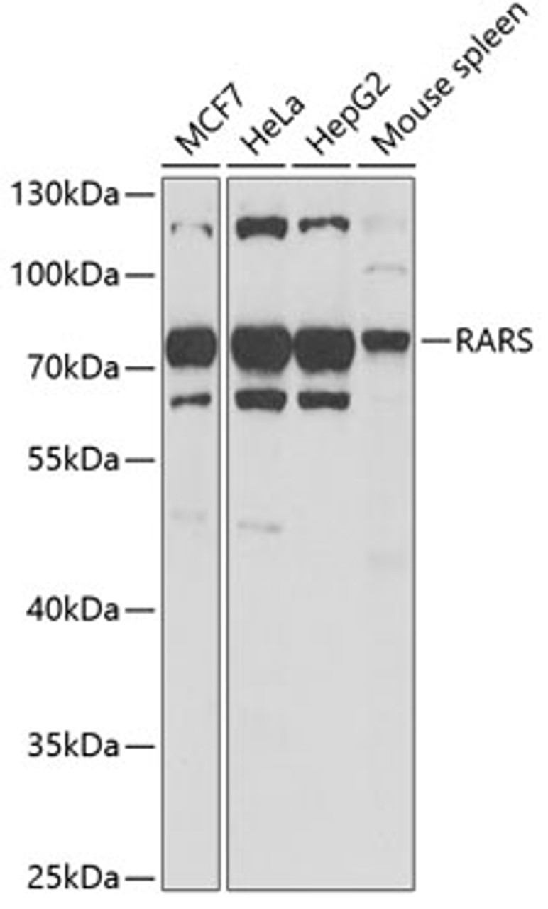 Western blot analysis of extracts of various cell lines, using RARS antibody (22-116) at 1:1000 dilution._Secondary antibody: HRP Goat Anti-Rabbit IgG (H+L) at 1:10000 dilution._Lysates/proteins: 25ug per lane._Blocking buffer: 3% nonfat dry milk in TBST._Detection: ECL Enhanced Kit._Exposure time: 30s.