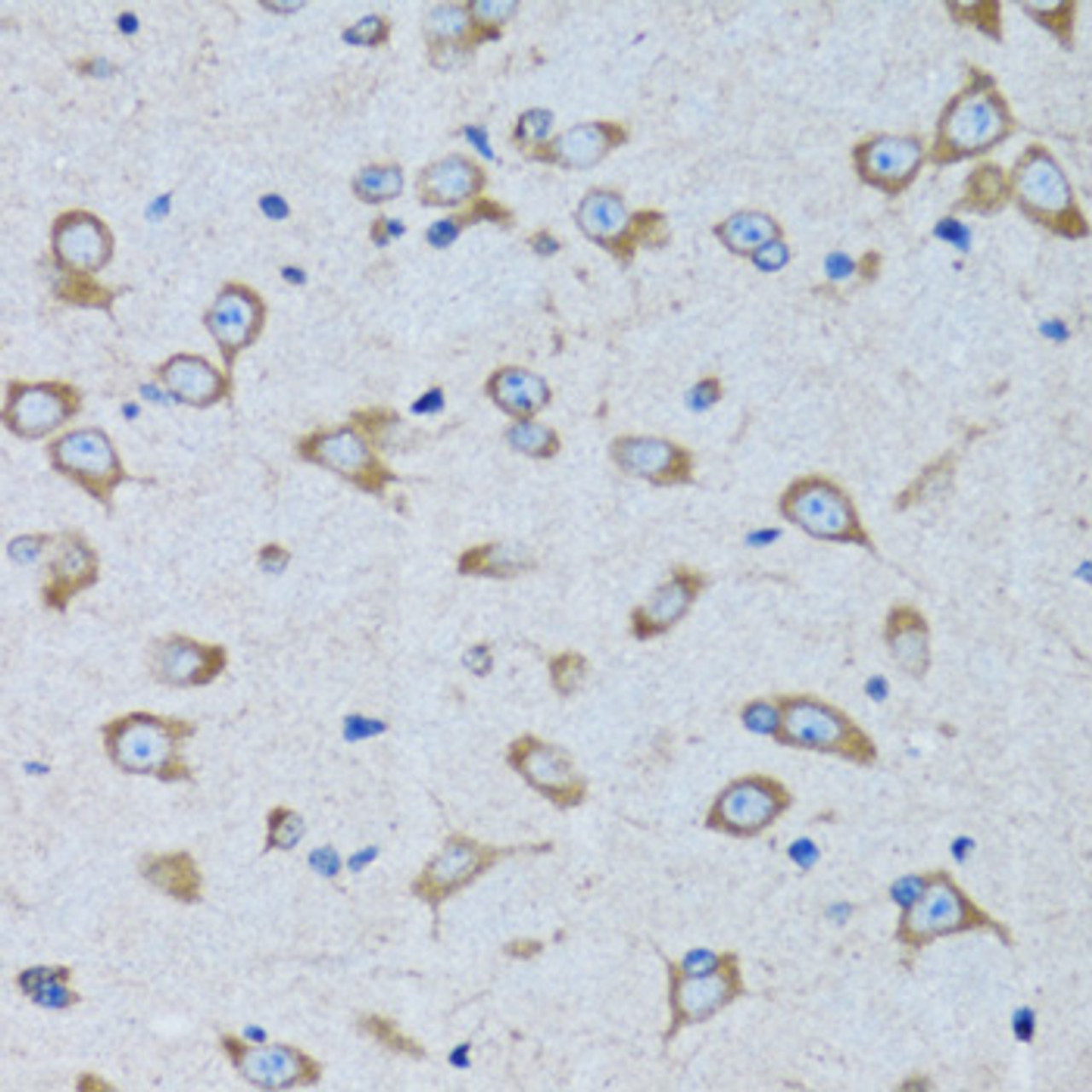 Immunohistochemistry of paraffin-embedded rat brain using RARS antibody (22-116) at dilution of 1:100 (40x lens) .