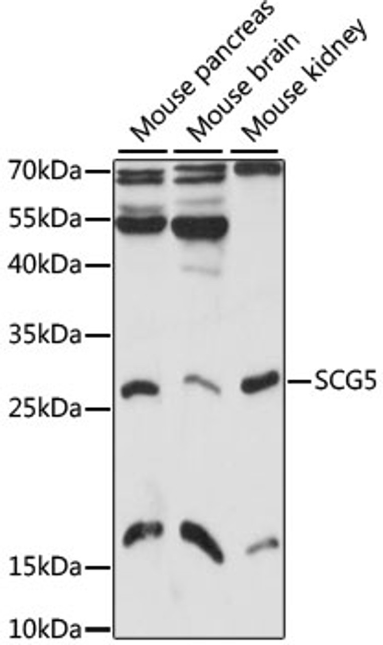 Western blot analysis of extracts of various cell lines, using SCG5 antibody (22-117) at 1:1000 dilution.<br/>Secondary antibody: HRP Goat Anti-Rabbit IgG (H+L) at 1:10000 dilution.<br/>Lysates/proteins: 25ug per lane.<br/>Blocking buffer: 3% nonfat dry milk in TBST.<br/>Detection: ECL Basic Kit.<br/>Exposure time: 15s.