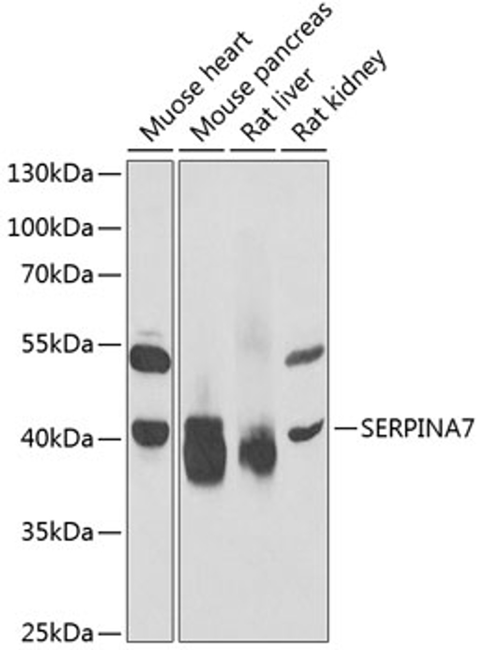 Western blot analysis of extracts of various cell lines, using SERPINA7 antibody (22-122) at 1:1000 dilution._Secondary antibody: HRP Goat Anti-Rabbit IgG (H+L) at 1:10000 dilution._Lysates/proteins: 25ug per lane._Blocking buffer: 3% nonfat dry milk in TBST._Detection: ECL Enhanced Kit._Exposure time: 30s.