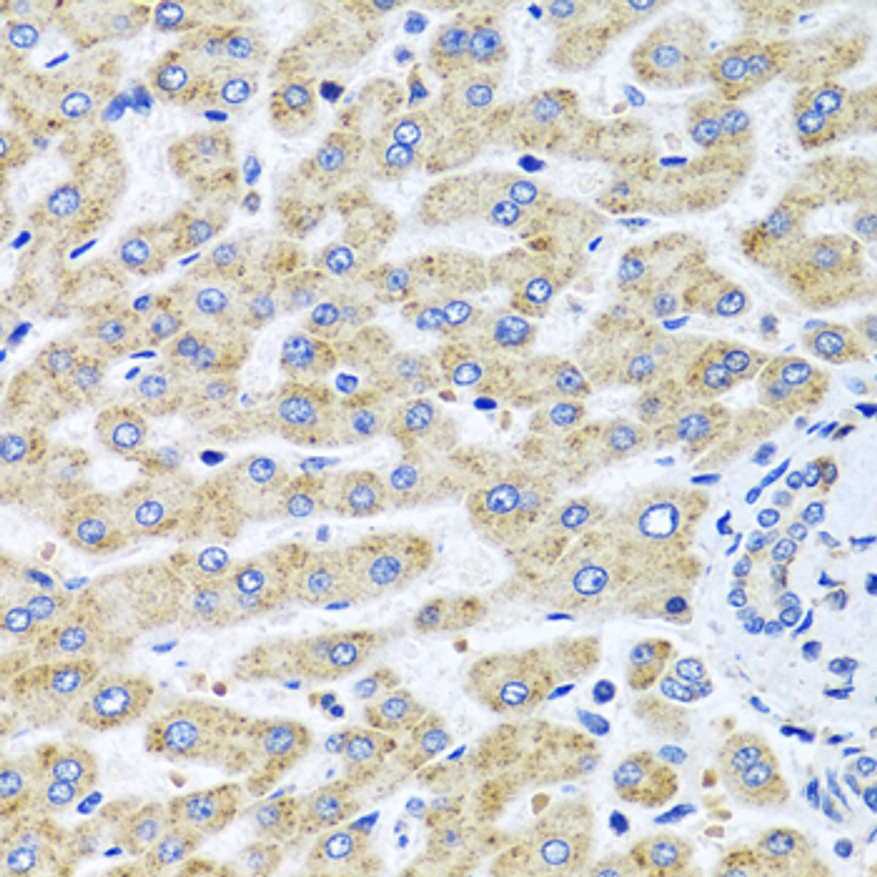 Immunohistochemistry of paraffin-embedded human liver using SERPINA7 antibody (22-122) at dilution of 1:100 (40x lens) .