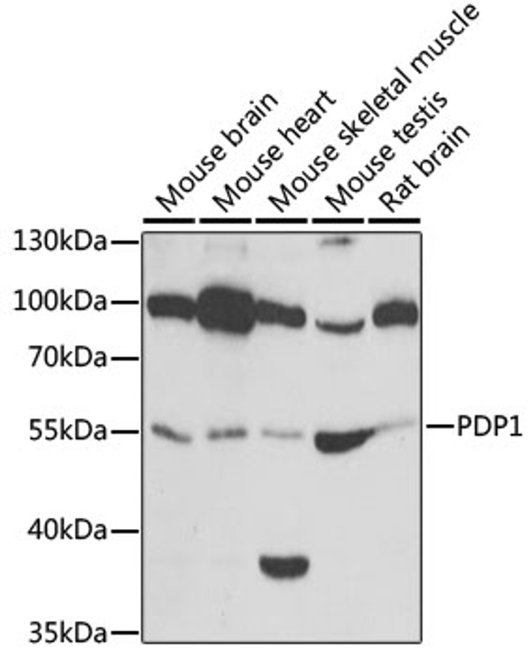 Western blot analysis of extracts of various cell lines, using PDP1 antibody (22-135) at 1:1000 dilution.<br/>Secondary antibody: HRP Goat Anti-Rabbit IgG (H+L) at 1:10000 dilution.<br/>Lysates/proteins: 25ug per lane.<br/>Blocking buffer: 3% nonfat dry milk in TBST.<br/>Detection: ECL Basic Kit.<br/>Exposure time: 30s.