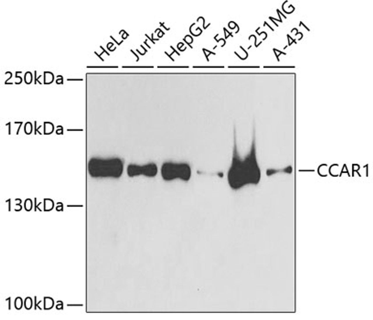 Western blot analysis of extracts of various cell lines, using CCAR1 antibody (22-137) at 1:1000 dilution.<br/>Secondary antibody: HRP Goat Anti-Rabbit IgG (H+L) at 1:10000 dilution.<br/>Lysates/proteins: 25ug per lane.<br/>Blocking buffer: 3% nonfat dry milk in TBST.<br/>Detection: ECL Basic Kit.<br/>Exposure time: 5s.