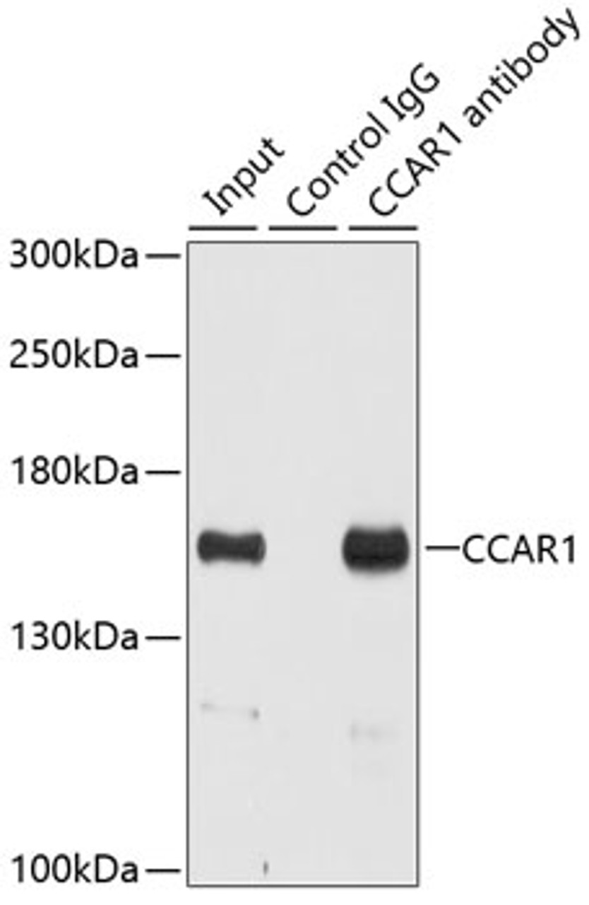 Immunoprecipitation analysis of 200ug extracts of HeLa cells using 3ug CCAR1 antibody (22-137) . Western blot was performed from the immunoprecipitate using CCAR1 antibody (22-137) at a dilition of 1:500.