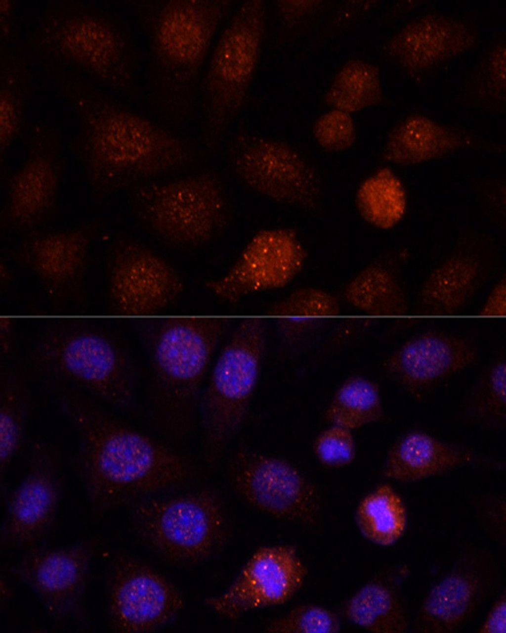 Immunofluorescence analysis of L-929 cells using PCGF1 antibody (22-140) at dilution of 1:100. Blue: DAPI for nuclear staining.