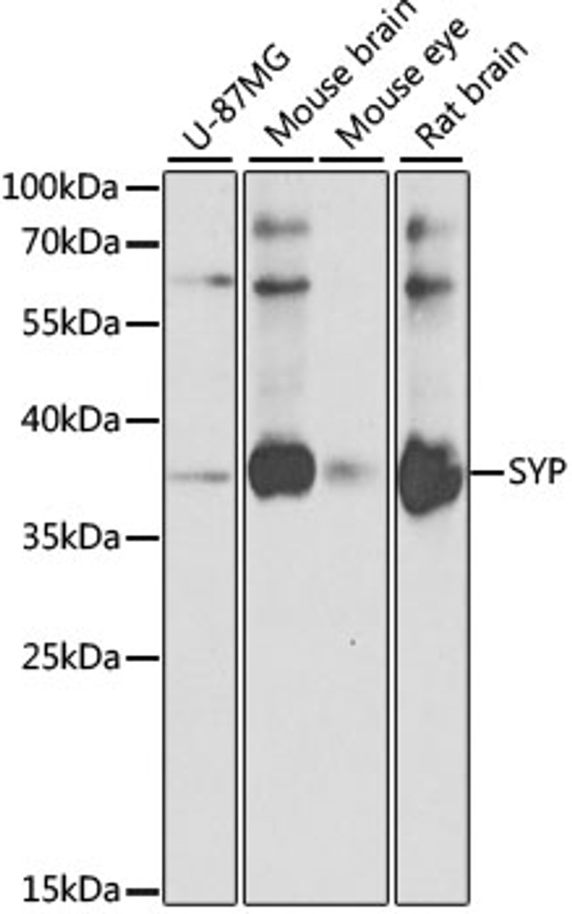 Western blot analysis of extracts of various cell lines, using SYP antibody (22-143) at 1:1000 dilution.<br/>Secondary antibody: HRP Goat Anti-Rabbit IgG (H+L) at 1:10000 dilution.<br/>Lysates/proteins: 25ug per lane.<br/>Blocking buffer: 3% nonfat dry milk in TBST.<br/>Detection: ECL Basic Kit.<br/>Exposure time: 20s.