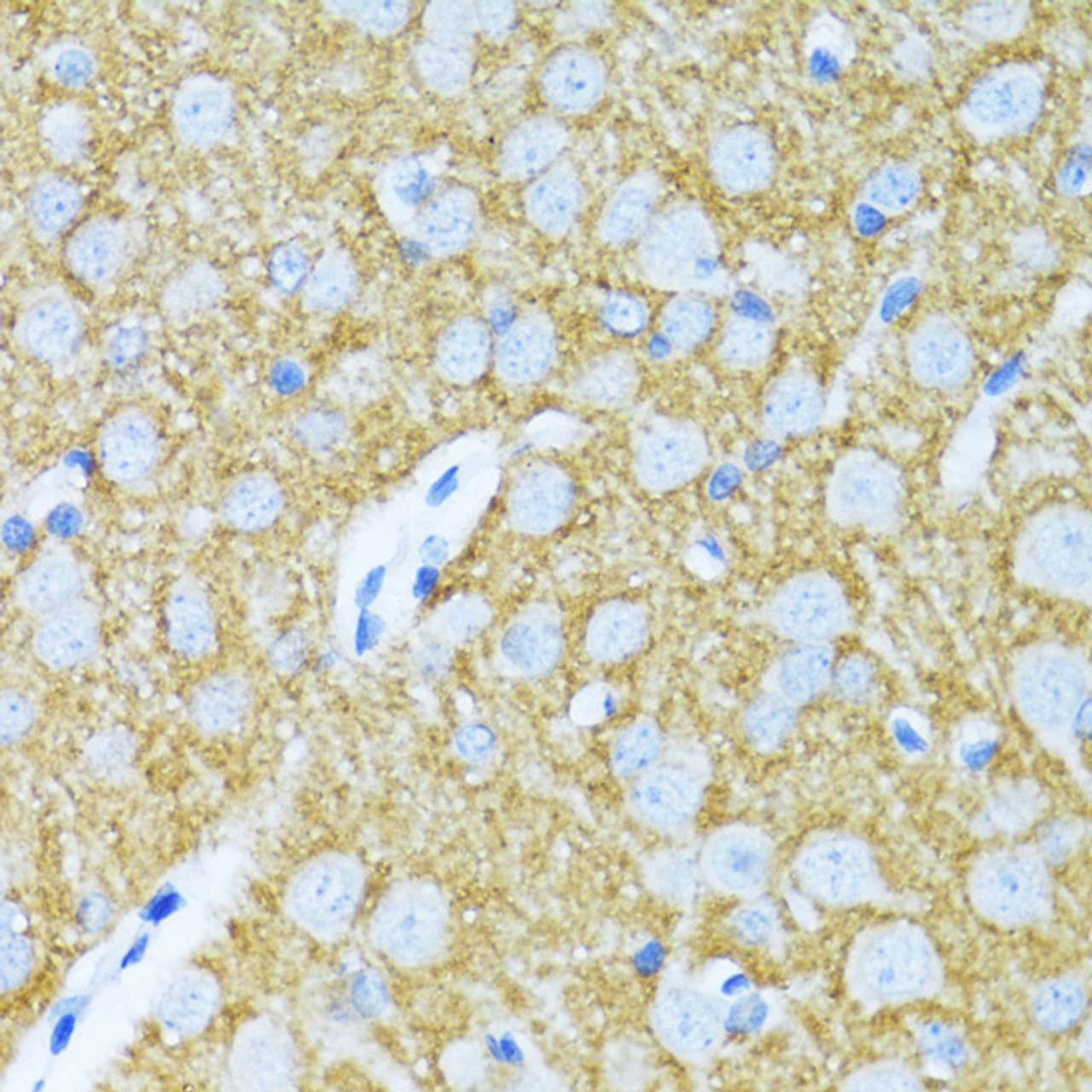 Immunohistochemistry of paraffin-embedded rat brain using SYP antibody (22-143) at dilution of 1:100 (40x lens) .