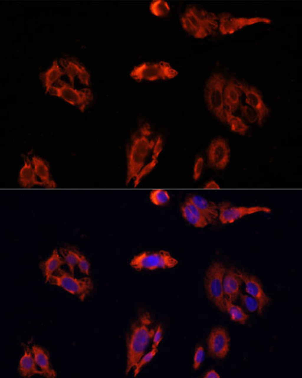 Immunofluorescence analysis of U2OS cells using FAP antibody (22-146) at dilution of 1:100. Blue: DAPI for nuclear staining.