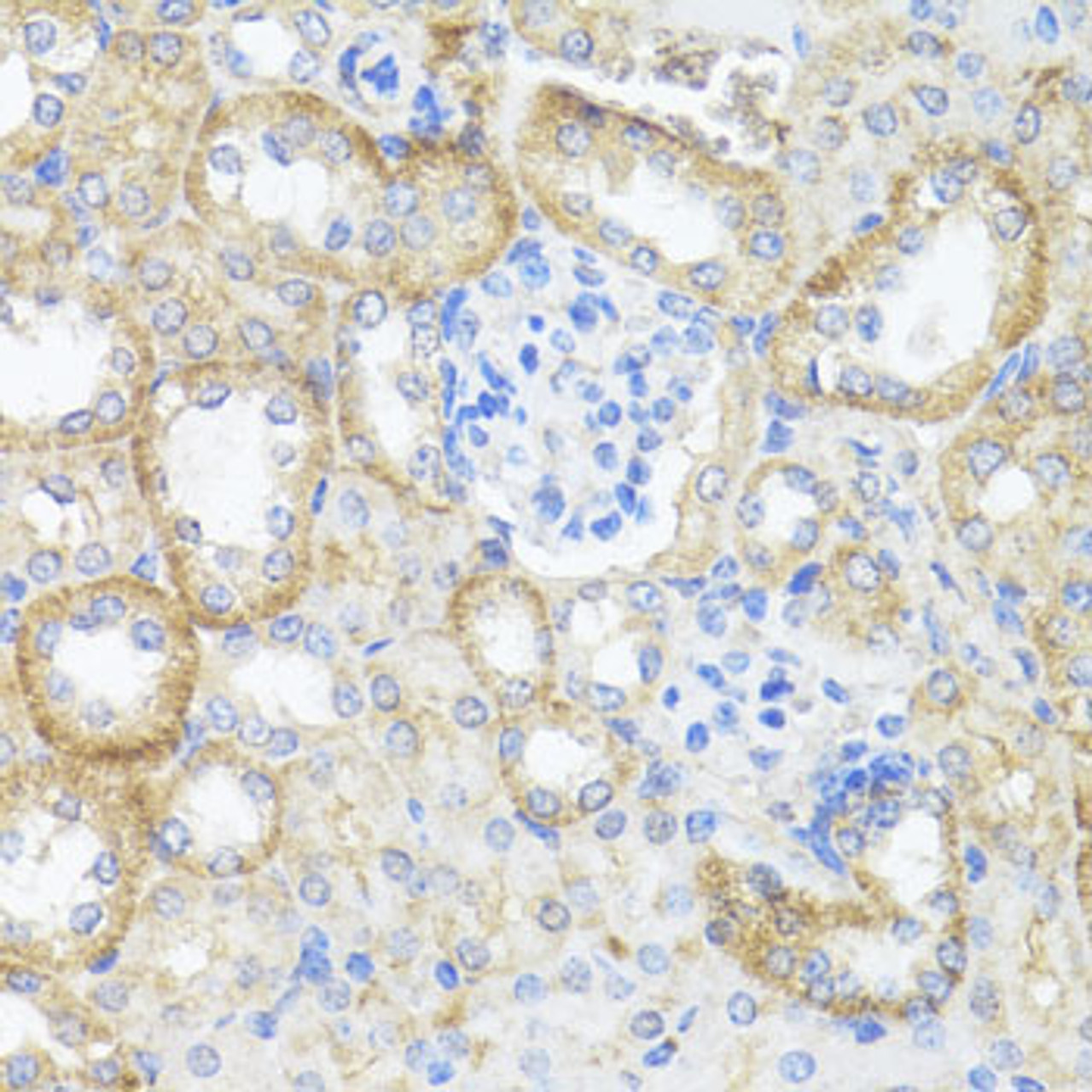 Immunohistochemistry of paraffin-embedded mouse kidney using ASL antibody (22-154) at dilution of 1:100 (40x lens) .