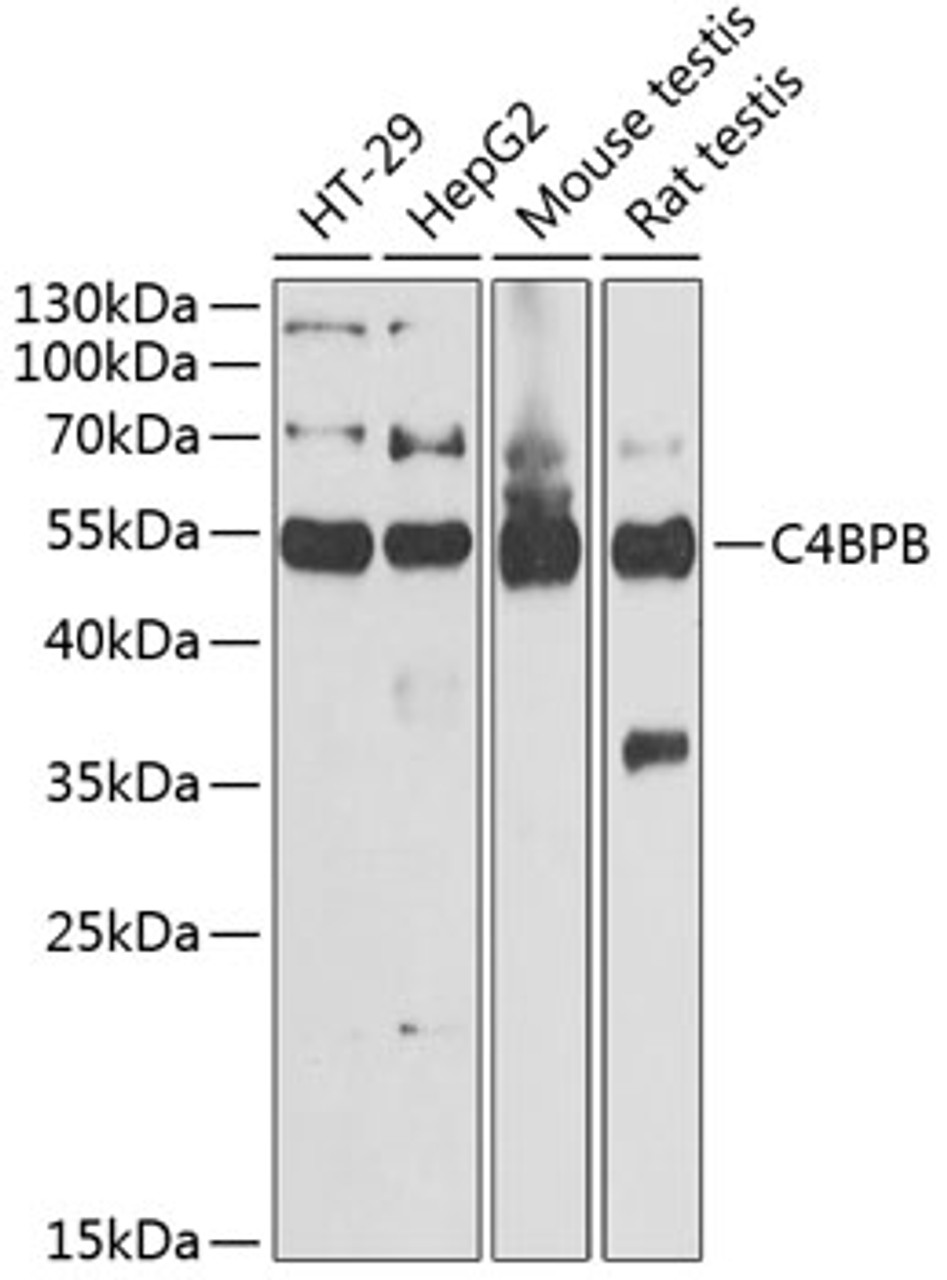 Western blot analysis of extracts of various cell lines, using C4BPB antibody (22-158) at 1:1000 dilution.<br/>Secondary antibody: HRP Goat Anti-Rabbit IgG (H+L) at 1:10000 dilution.<br/>Lysates/proteins: 25ug per lane.<br/>Blocking buffer: 3% nonfat dry milk in TBST.<br/>Detection: ECL Basic Kit.<br/>Exposure time: 30s.