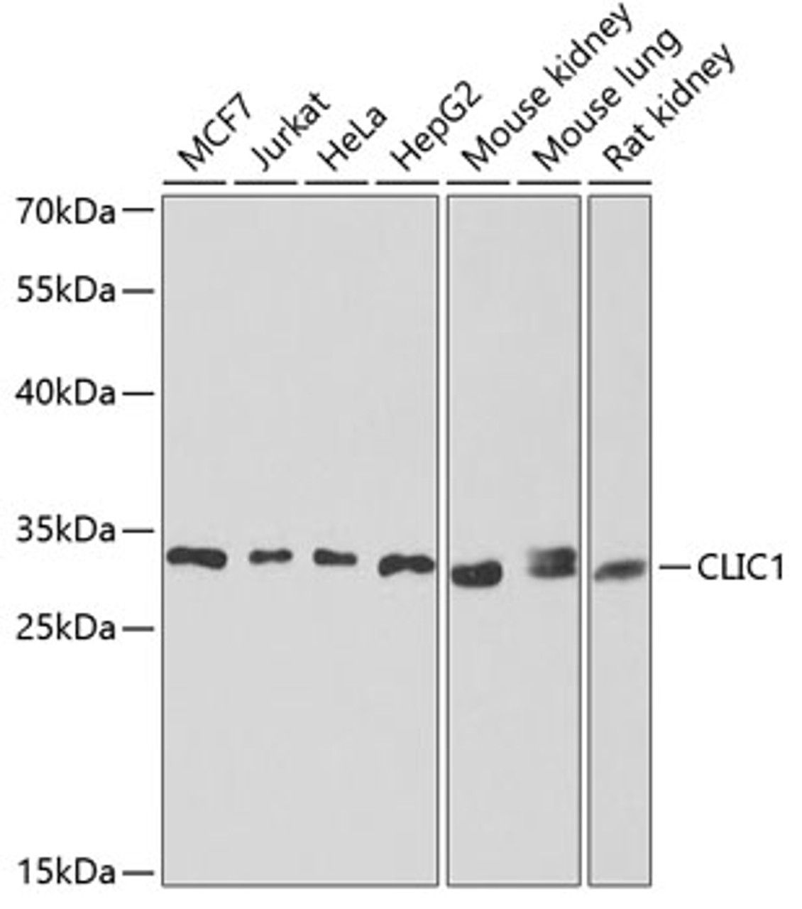 Western blot analysis of extracts of various cell lines, using CLIC1 antibody (22-159) at 1:1000 dilution._Secondary antibody: HRP Goat Anti-Rabbit IgG (H+L) at 1:10000 dilution._Lysates/proteins: 25ug per lane._Blocking buffer: 3% nonfat dry milk in TBST._Detection: ECL Enhanced Kit._Exposure time: 30s.