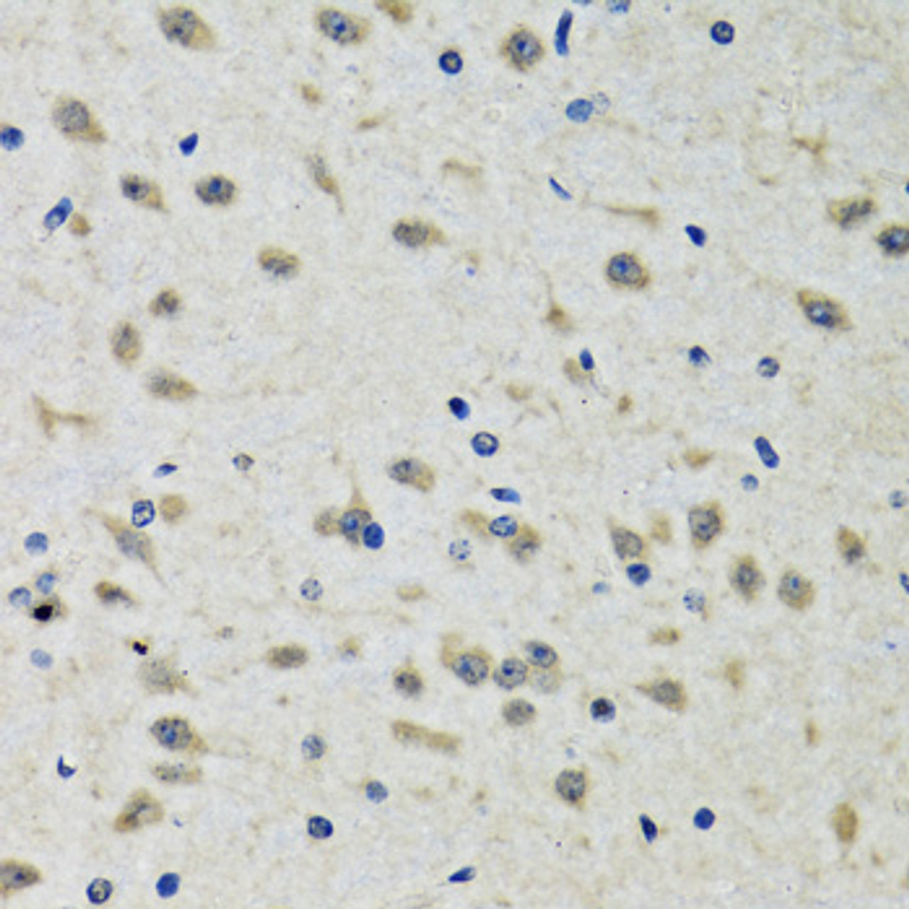 Immunohistochemistry of paraffin-embedded rat brain using CLIC1 antibody (22-159) at dilution of 1:100 (40x lens) .