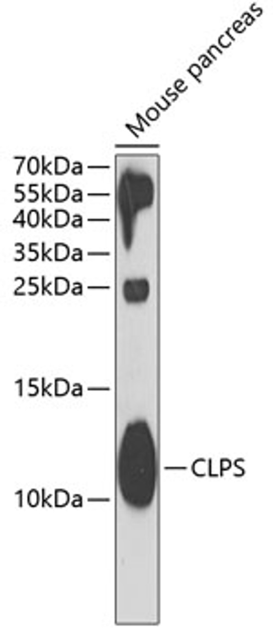 Western blot analysis of extracts of mouse pancreas, using CLPS antibody (22-160) at 1:1000 dilution.<br/>Secondary antibody: HRP Goat Anti-Rabbit IgG (H+L) at 1:10000 dilution.<br/>Lysates/proteins: 25ug per lane.<br/>Blocking buffer: 3% nonfat dry milk in TBST.<br/>Detection: ECL Basic Kit.<br/>Exposure time: 30s.