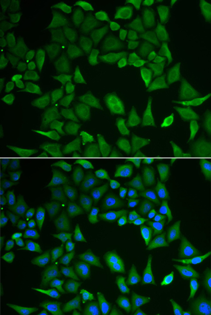 Immunofluorescence analysis of HeLa cells using CLPS antibody (22-160) . Blue: DAPI for nuclear staining.