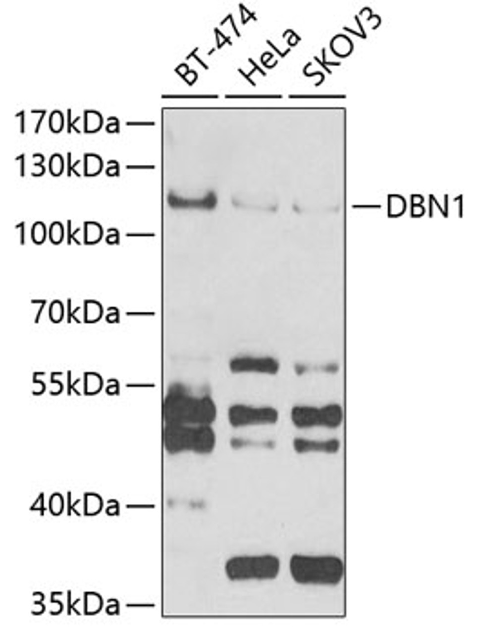 Western blot analysis of extracts of various cell lines, using DBN1 antibody (22-162) at 1:1000 dilution.<br/>Secondary antibody: HRP Goat Anti-Rabbit IgG (H+L) at 1:10000 dilution.<br/>Lysates/proteins: 25ug per lane.<br/>Blocking buffer: 3% nonfat dry milk in TBST.<br/>Detection: ECL Basic Kit.<br/>Exposure time: 90s.