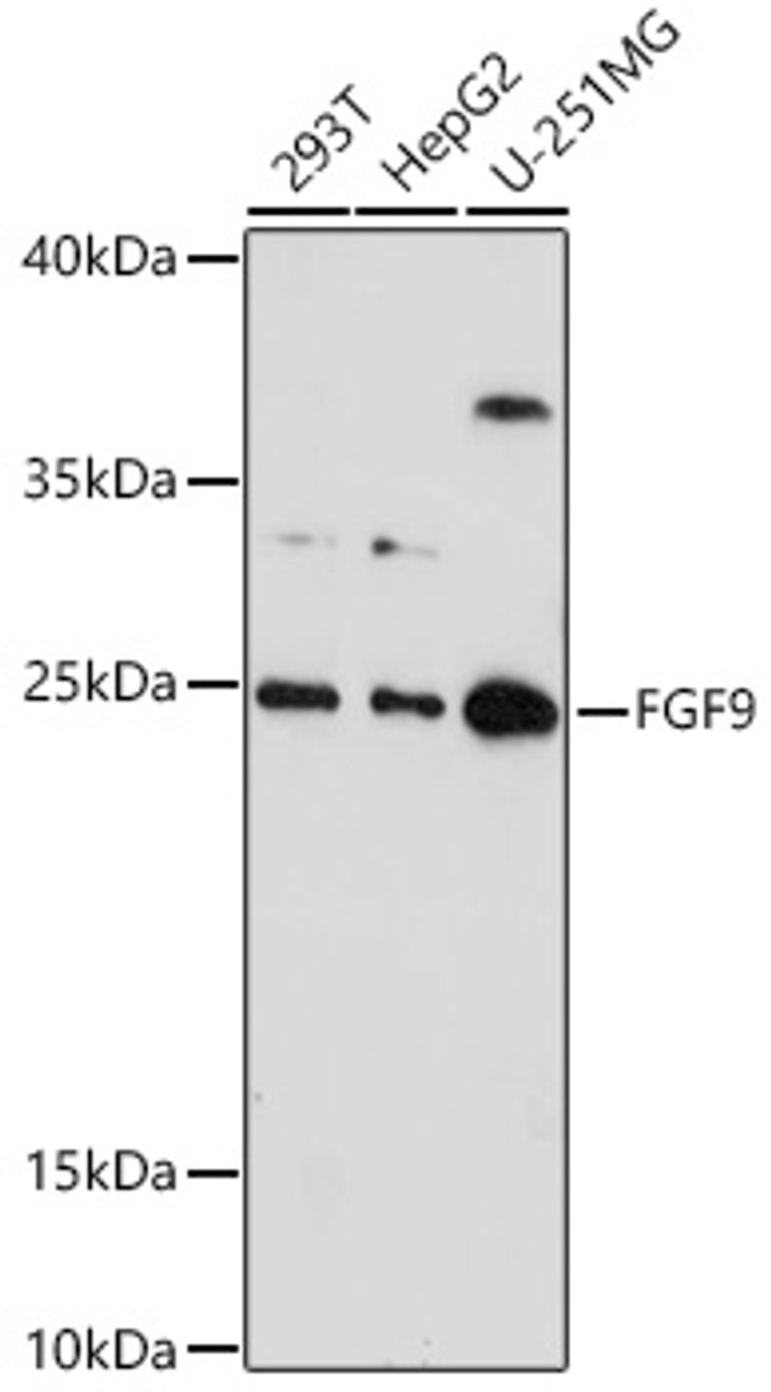 Western blot analysis of extracts of various cell lines, using FGF9 antibody (22-170) at 1:1000 dilution.<br/>Secondary antibody: HRP Goat Anti-Rabbit IgG (H+L) at 1:10000 dilution.<br/>Lysates/proteins: 25ug per lane.<br/>Blocking buffer: 3% nonfat dry milk in TBST.<br/>Detection: ECL Basic Kit.<br/>Exposure time: 180s.