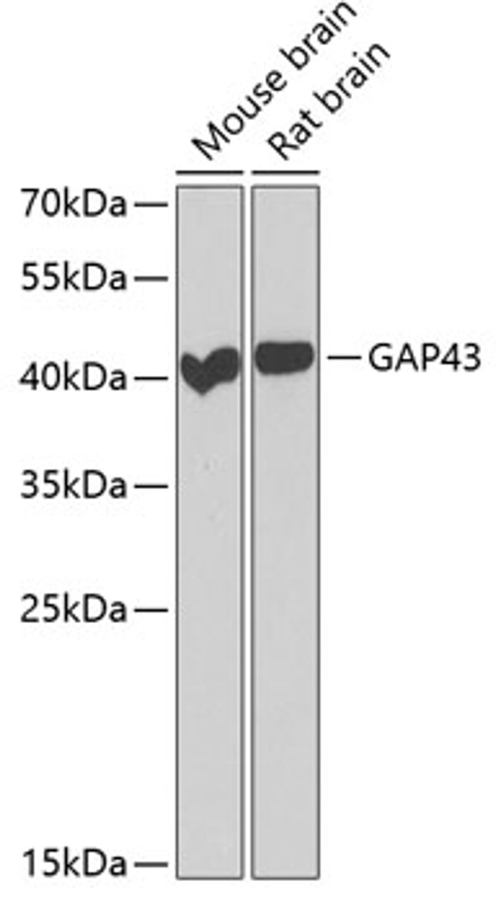 Western blot analysis of extracts of various cell lines, using GAP43 antibody (22-172) at 1:1000 dilution.<br/>Secondary antibody: HRP Goat Anti-Rabbit IgG (H+L) at 1:10000 dilution.<br/>Lysates/proteins: 25ug per lane.<br/>Blocking buffer: 3% nonfat dry milk in TBST.<br/>Detection: ECL Basic Kit.<br/>Exposure time: 90s.