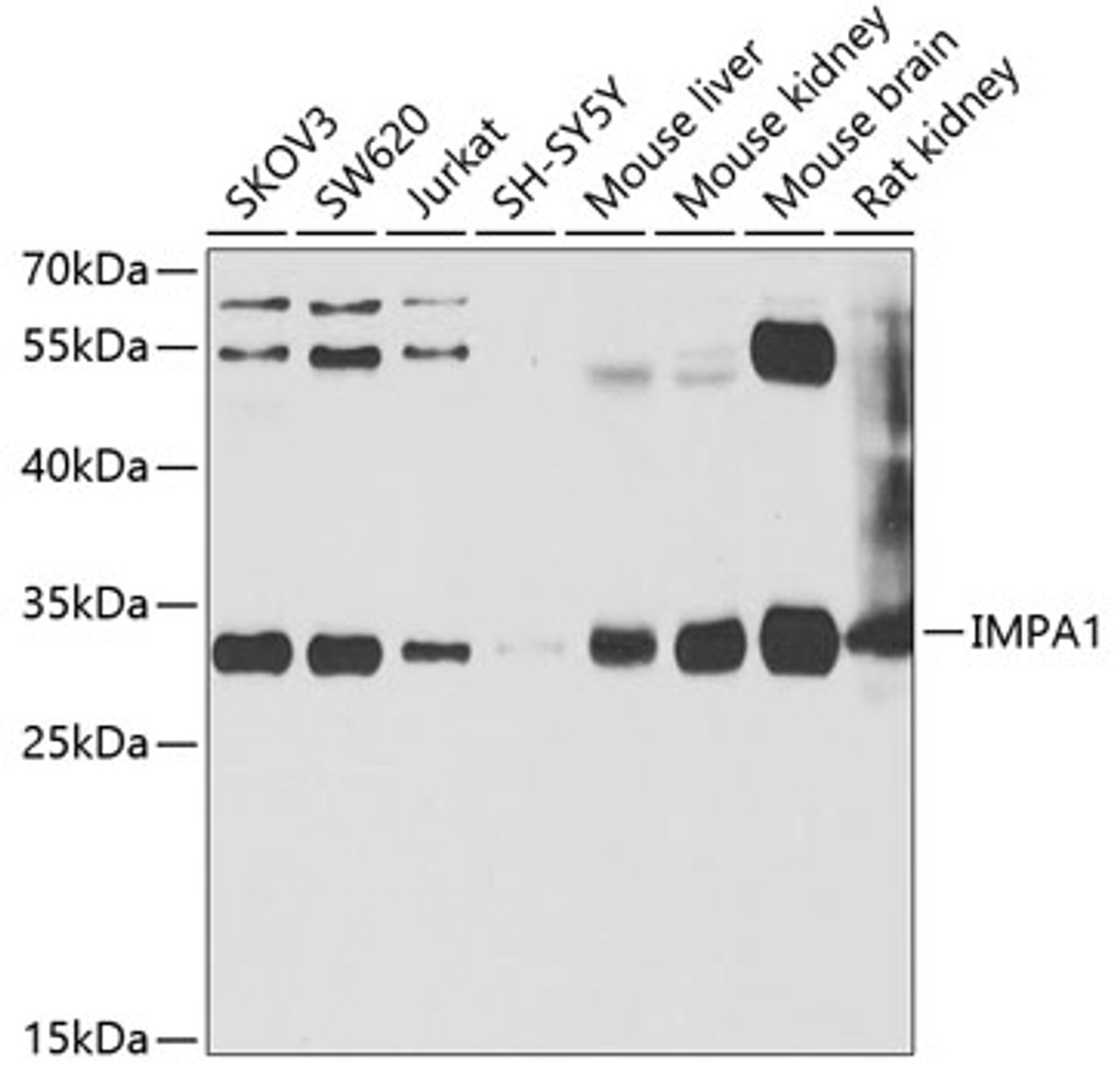 Western blot analysis of extracts of various cell lines, using IMPA1 antibody (22-174) at 1:1000 dilution.<br/>Secondary antibody: HRP Goat Anti-Rabbit IgG (H+L) at 1:10000 dilution.<br/>Lysates/proteins: 25ug per lane.<br/>Blocking buffer: 3% nonfat dry milk in TBST.<br/>Detection: ECL Basic Kit.<br/>Exposure time: 90s.