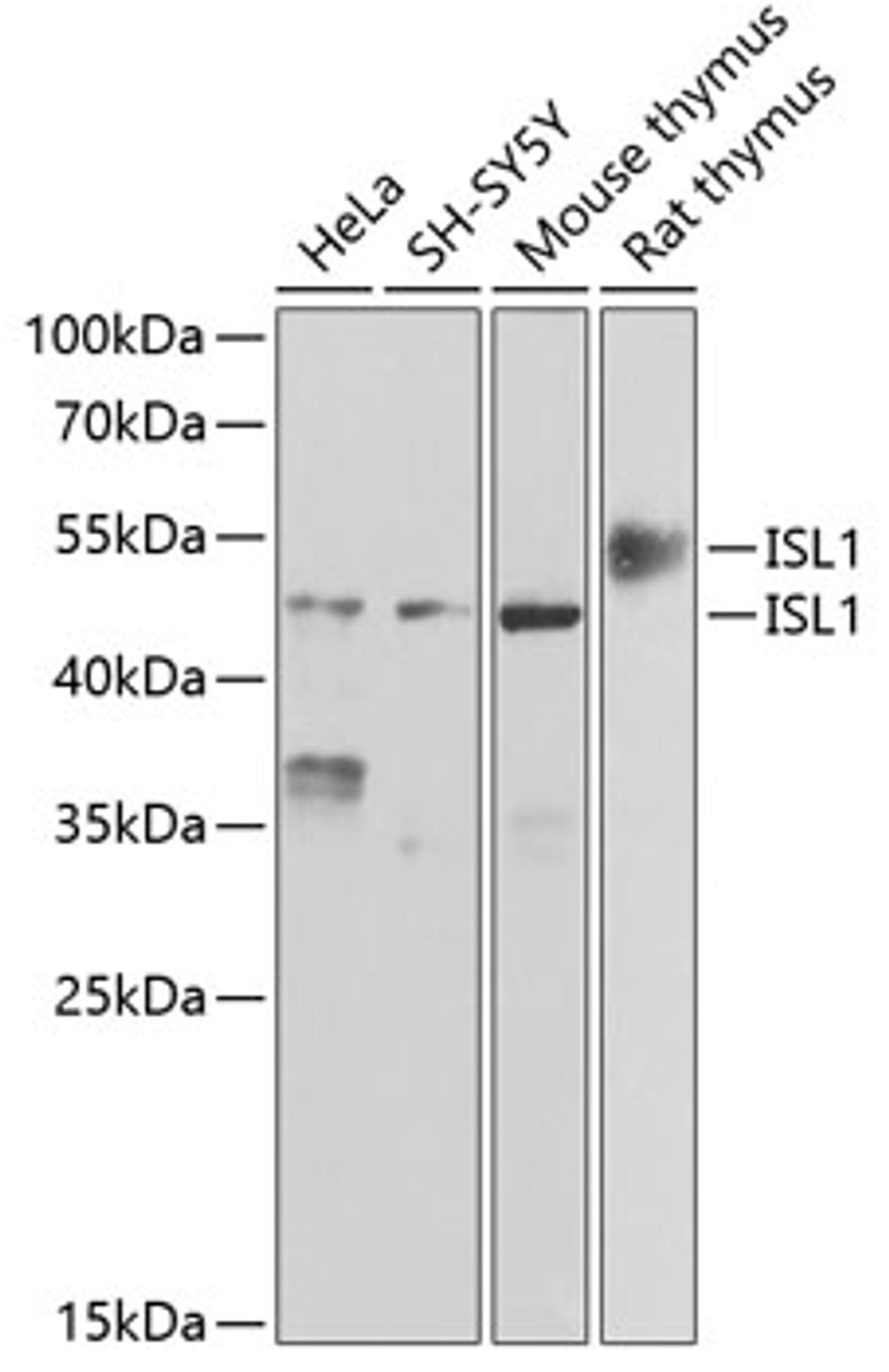 Western blot analysis of extracts of various cell lines, using ISL1 antibody (22-175) at 1:500 dilution.<br/>Secondary antibody: HRP Goat Anti-Rabbit IgG (H+L) at 1:10000 dilution.<br/>Lysates/proteins: 25ug per lane.<br/>Blocking buffer: 3% nonfat dry milk in TBST.<br/>Detection: ECL Basic Kit.<br/>Exposure time: 5s.