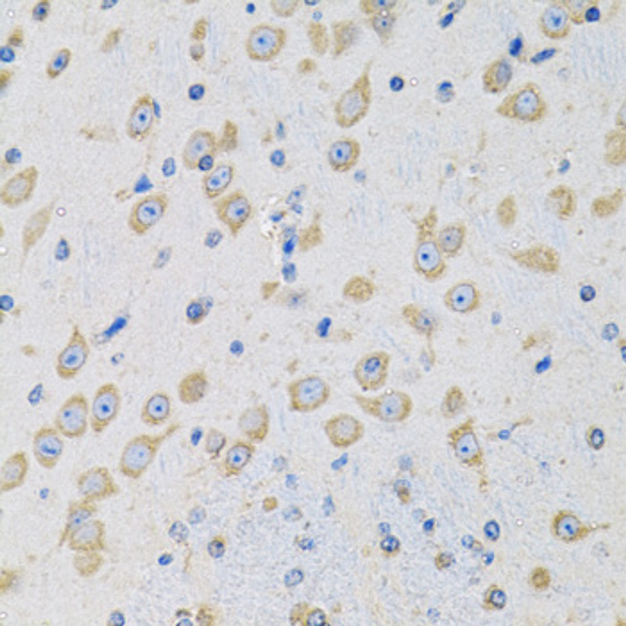 Immunohistochemistry of paraffin-embedded mouse brain using MSRA antibody (22-180) at dilution of 1:100 (40x lens) .