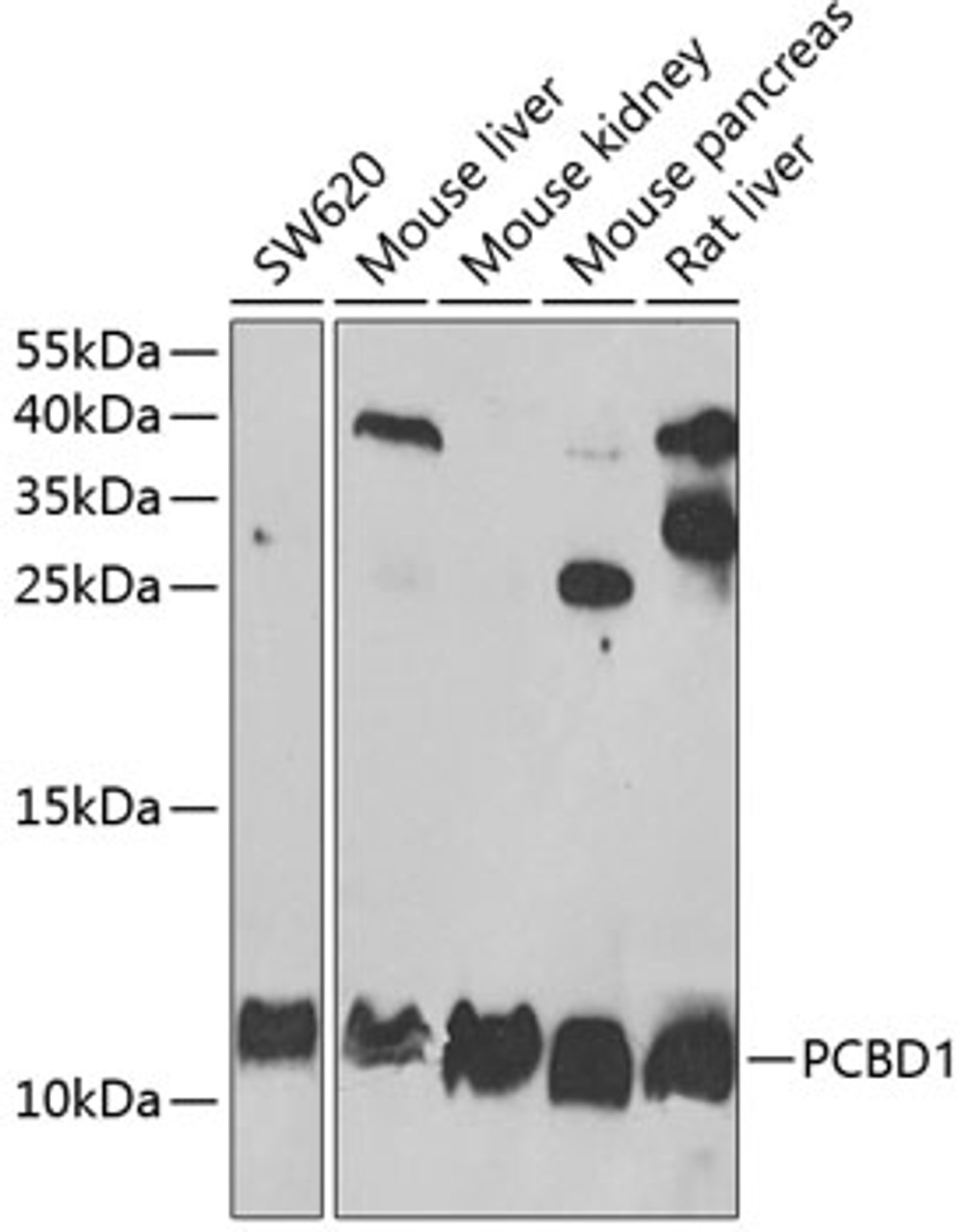 Western blot analysis of extracts of various cell lines, using PCBD1 antibody (22-182) at 1:1000 dilution.<br/>Secondary antibody: HRP Goat Anti-Rabbit IgG (H+L) at 1:10000 dilution.<br/>Lysates/proteins: 25ug per lane.<br/>Blocking buffer: 3% nonfat dry milk in TBST.<br/>Detection: ECL Basic Kit.<br/>Exposure time: 90s.