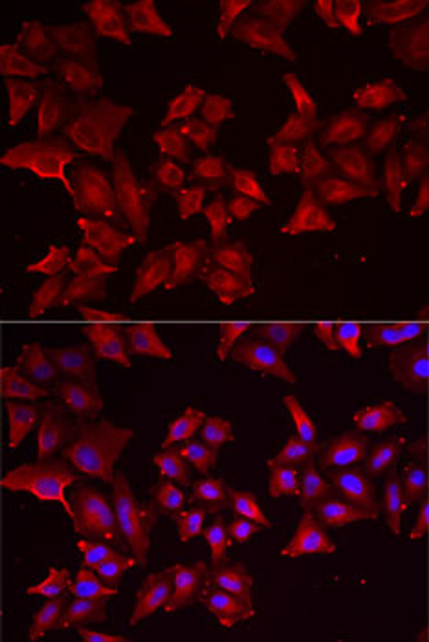Immunofluorescence analysis of MCF7 cells using PCBD1 antibody (22-182) . Blue: DAPI for nuclear staining.