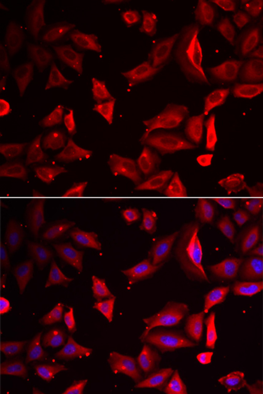 Immunofluorescence analysis of HeLa cells using SERPINB9 antibody (22-183) . Blue: DAPI for nuclear staining.