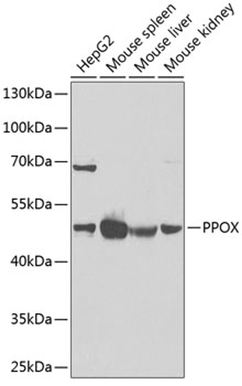 Western blot analysis of extracts of various cell lines, using PPOX Antibody (22-187) at 1:1000 dilution.<br/>Secondary antibody: HRP Goat Anti-Rabbit IgG (H+L) at 1:10000 dilution.<br/>Lysates/proteins: 25ug per lane.<br/>Blocking buffer: 3% nonfat dry milk in TBST.<br/>Detection: ECL Enhanced Kit.<br/>Exposure time: 90s.