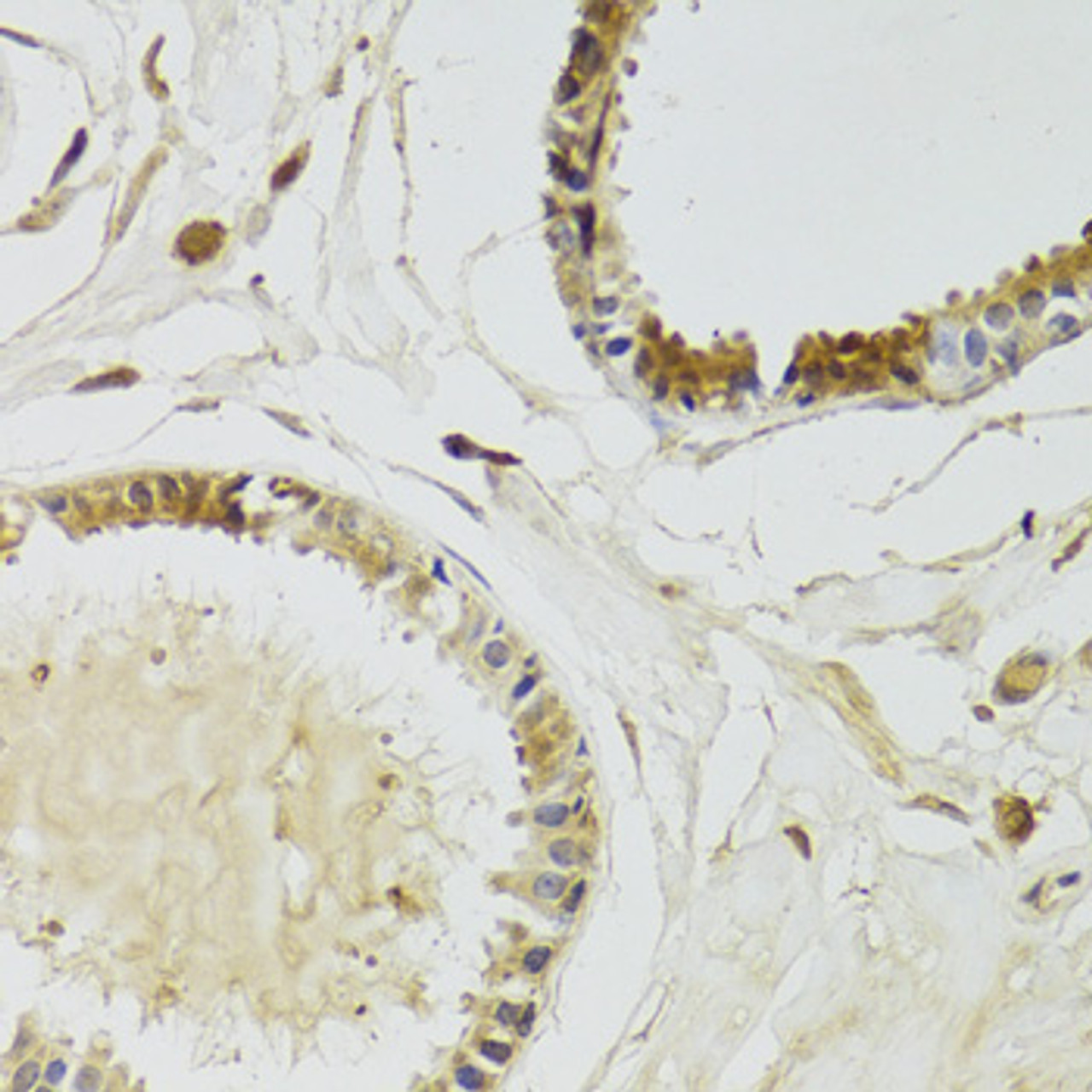 Immunohistochemistry of paraffin-embedded human breast using KLK10 Antibody (22-188) at dilution of 1:100 (40x lens) .