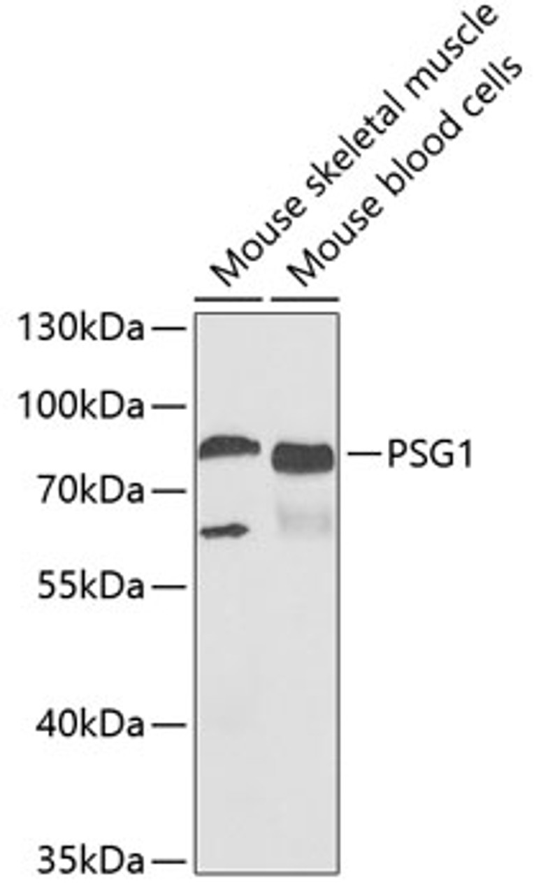 Western blot analysis of extracts of various cell lines, using PSG1 antibody (22-189) at 1:1000 dilution.<br/>Secondary antibody: HRP Goat Anti-Rabbit IgG (H+L) at 1:10000 dilution.<br/>Lysates/proteins: 25ug per lane.<br/>Blocking buffer: 3% nonfat dry milk in TBST.<br/>Detection: ECL Basic Kit.<br/>Exposure time: 90s.