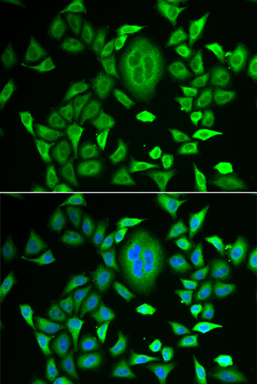 Immunofluorescence analysis of MCF-7 cells using RBP3 antibody (22-193) . Blue: DAPI for nuclear staining.