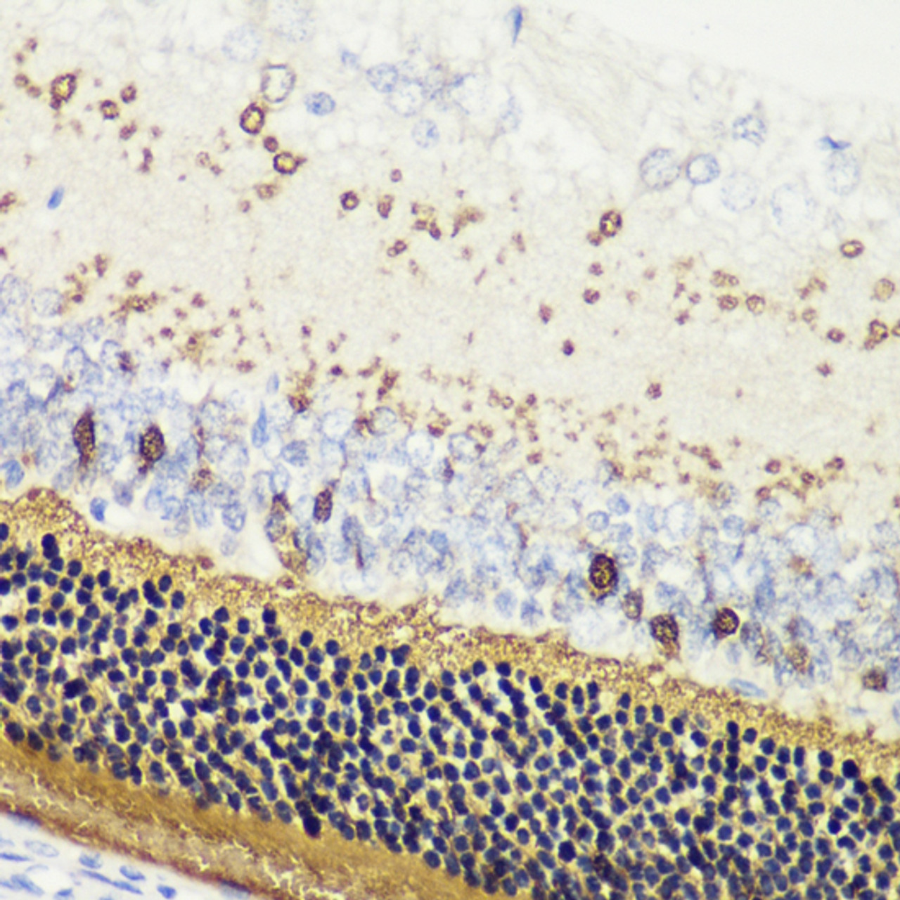 Immunohistochemistry of paraffin-embedded rat retina using RCVRN antibody (22-194) at dilution of 1:200 (40x lens) .