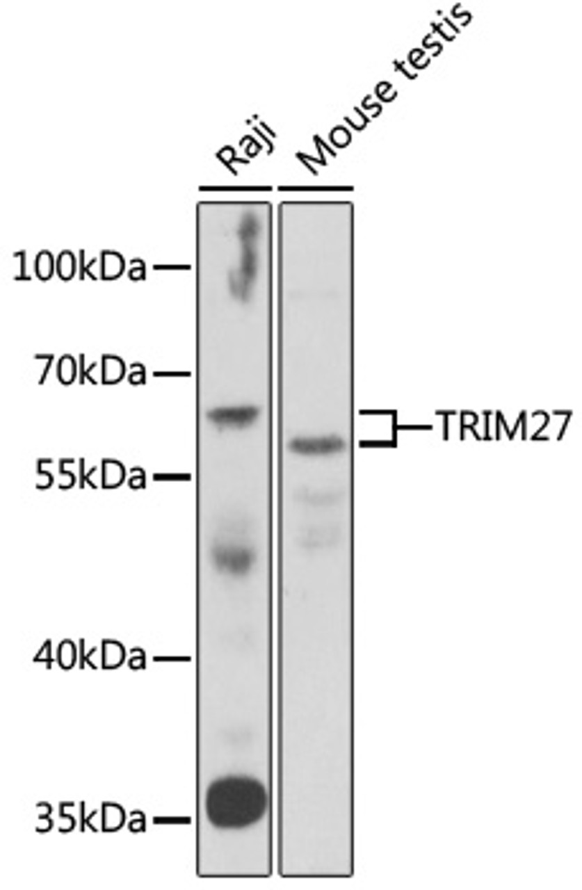 Western blot analysis of extracts of various cell lines, using TRIM27 antibody (22-195) at 1:1000 dilution.<br/>Secondary antibody: HRP Goat Anti-Rabbit IgG (H+L) at 1:10000 dilution.<br/>Lysates/proteins: 25ug per lane.<br/>Blocking buffer: 3% nonfat dry milk in TBST.<br/>Detection: ECL Basic Kit.<br/>Exposure time: 1s.