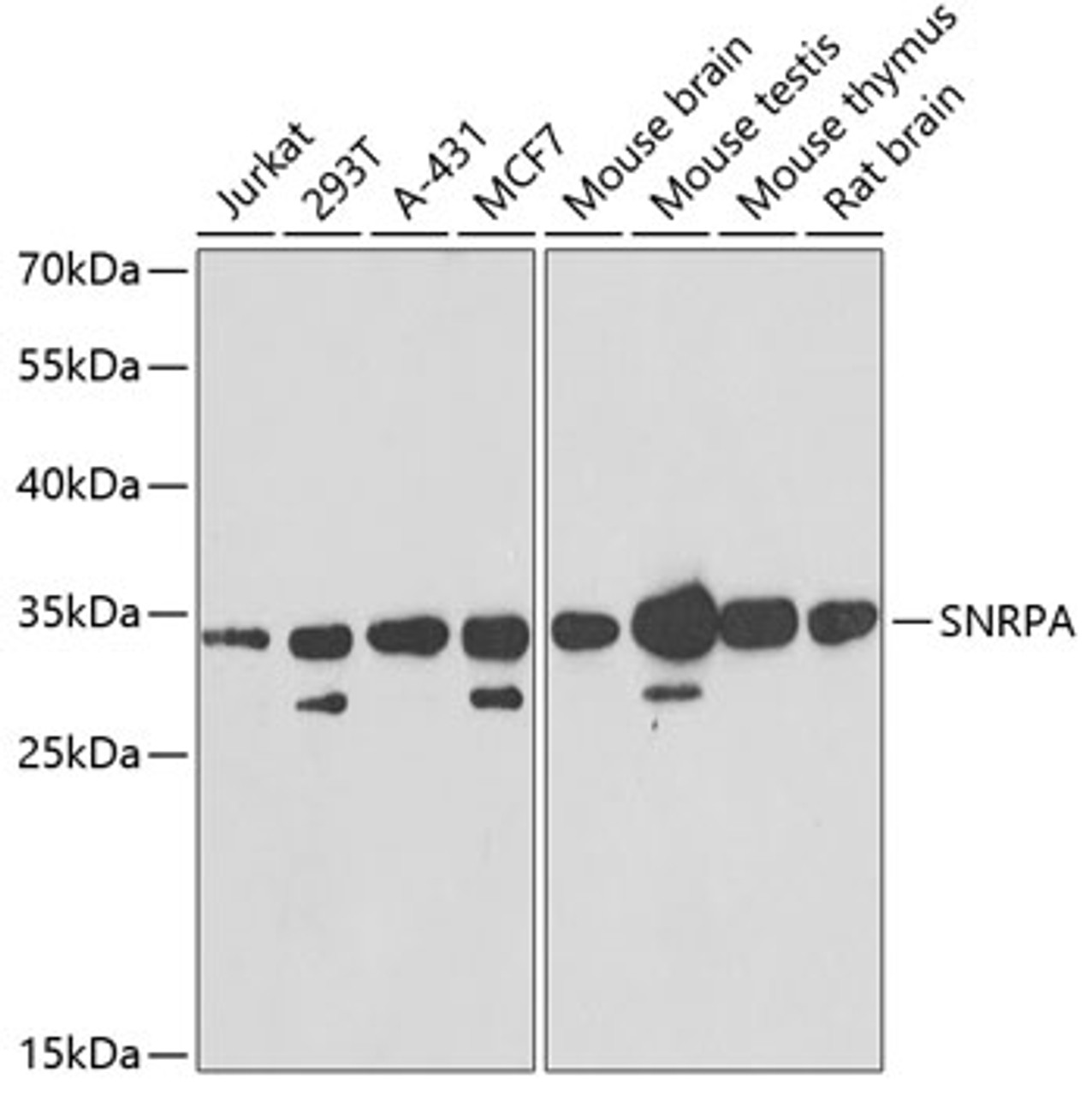 Western blot analysis of extracts of various cell lines, using SNRPA antibody (22-200) at 1:1000 dilution.<br/>Secondary antibody: HRP Goat Anti-Rabbit IgG (H+L) at 1:10000 dilution.<br/>Lysates/proteins: 25ug per lane.<br/>Blocking buffer: 3% nonfat dry milk in TBST.<br/>Detection: ECL Basic Kit.<br/>Exposure time: 90s.