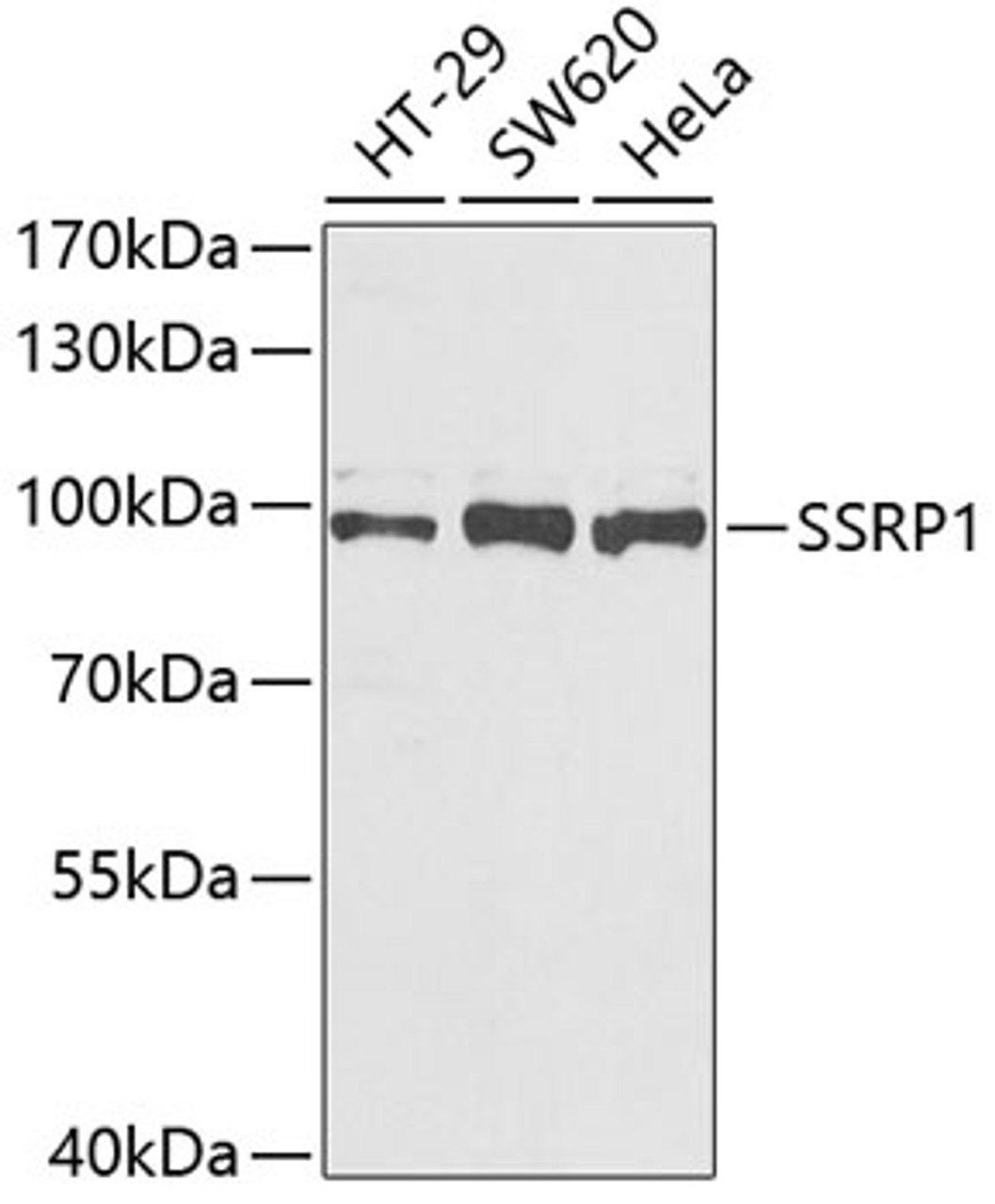 Western blot analysis of extracts of various cell lines, using SSRP1 antibody (22-202) at 1:1000 dilution.<br/>Secondary antibody: HRP Goat Anti-Rabbit IgG (H+L) at 1:10000 dilution.<br/>Lysates/proteins: 25ug per lane.<br/>Blocking buffer: 3% nonfat dry milk in TBST.<br/>Detection: ECL Enhanced Kit.<br/>Exposure time: 90s.