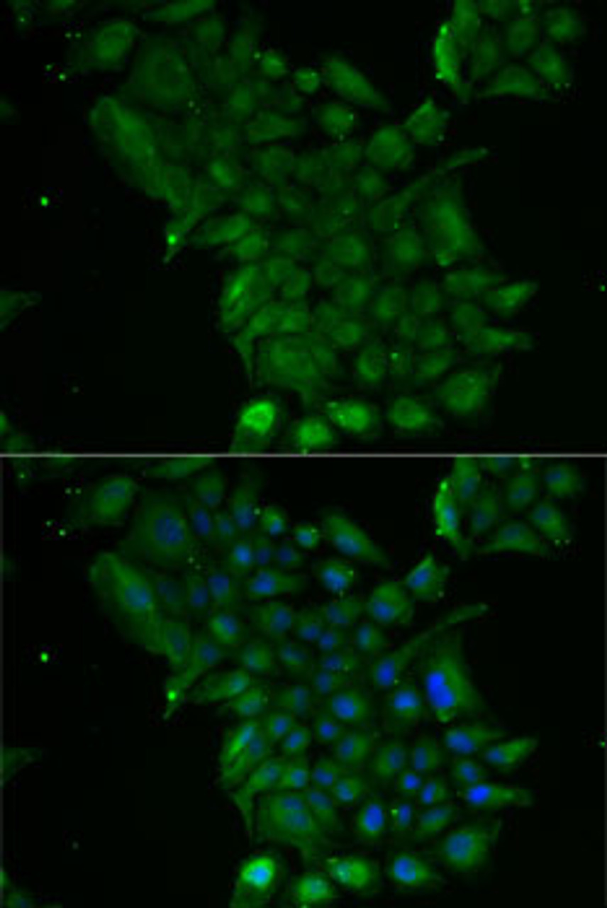 Immunofluorescence analysis of MCF7 cells using TCN1 antibody (22-203) . Blue: DAPI for nuclear staining.