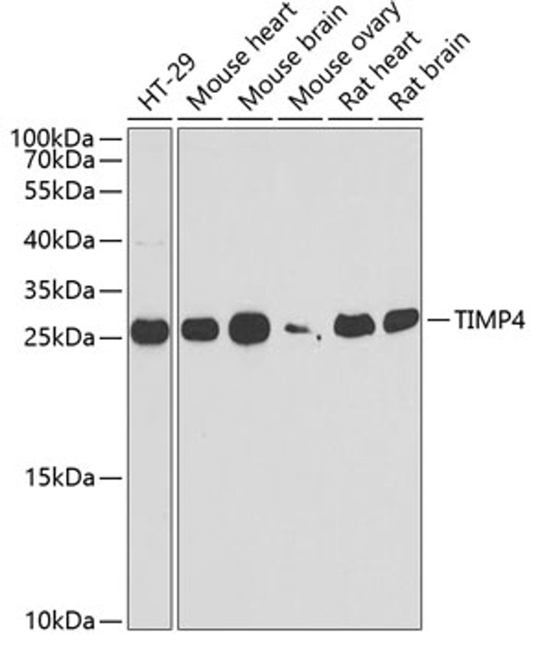 Western blot analysis of extracts of various cell lines, using TIMP4 antibody (22-204) at 1:1000 dilution.<br/>Secondary antibody: HRP Goat Anti-Rabbit IgG (H+L) at 1:10000 dilution.<br/>Lysates/proteins: 25ug per lane.<br/>Blocking buffer: 3% nonfat dry milk in TBST.<br/>Detection: ECL Basic Kit.<br/>Exposure time: 90s.