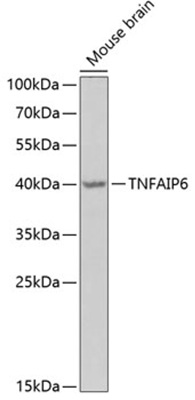 Western blot analysis of extracts of mouse brain, using TNFAIP6 Antibody (22-206) at 1:1000 dilution._Secondary antibody: HRP Goat Anti-Rabbit IgG (H+L) at 1:10000 dilution._Lysates/proteins: 25ug per lane._Blocking buffer: 3% nonfat dry milk in TBST._Detection: ECL Enhanced Kit._Exposure time: 90s.