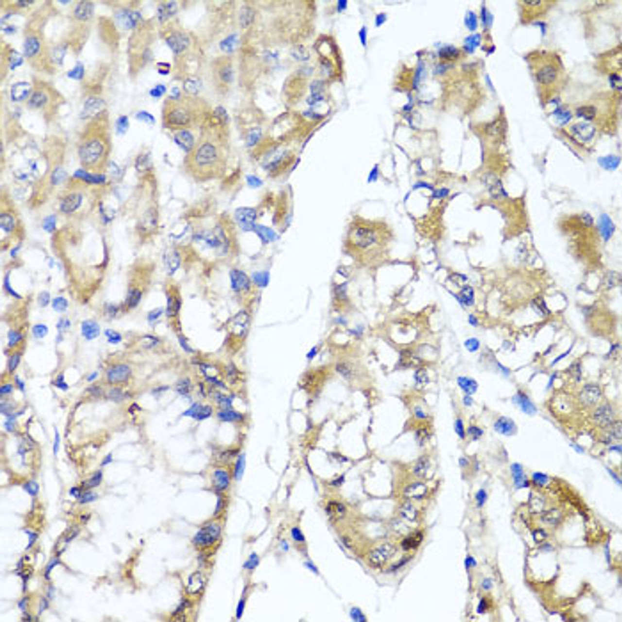 Immunohistochemistry of paraffin-embedded human stomach using TNFAIP6 antibody (22-206) at dilution of 1:100 (40x lens) .