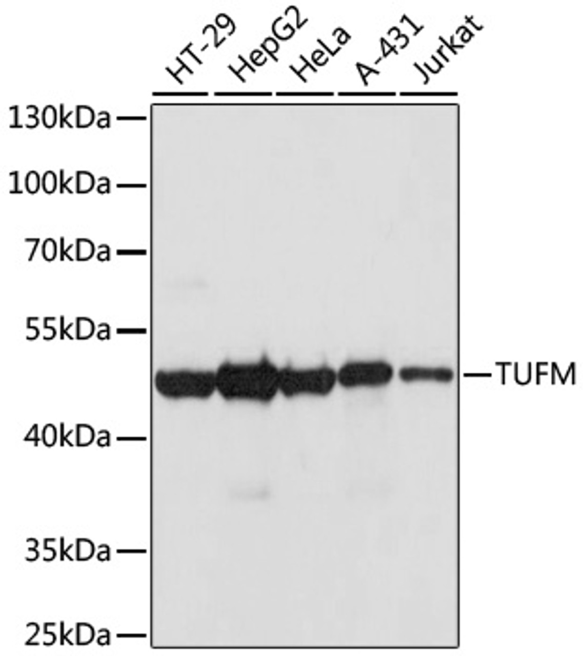 Immunohistochemistry of paraffin-embedded human esophageal cancer using TUFM antibody (22-209) at dilution of 1:100 (40x lens) .